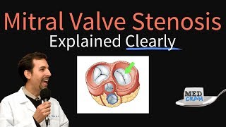 Mitral Valve Stenosis Explained Clearly  Pathophysiology Symptoms Treatment [upl. by Alard]