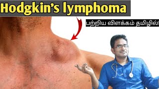 Hodgkins lymphoma medical awareness in tamil [upl. by Whipple]