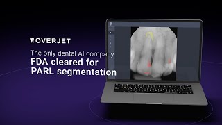 Firstofitskind FDAcleared PARL segmentation capabilities [upl. by Sylirama]