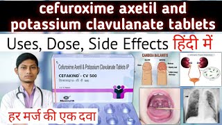 cefuroxime axetil and potassium clavulanate tablets  cefakind cv 500 mg tablet uses in hindi [upl. by Ennovyhs955]