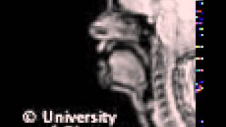 Voiced uvular plosive MRI [upl. by Asil]