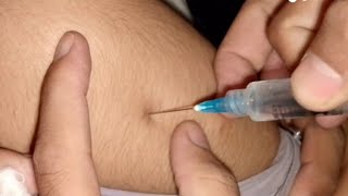 Injection lagane ka tarika  how to give intramuscular injection  nursing school Ep02 [upl. by Eerol790]