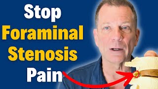 7 Steps to Beat Foraminal Stenosis Without Surgery amp Relieve Nerve Pain  Dr John Zielonka [upl. by Aneris]