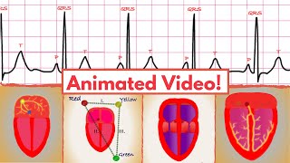 Sinus Rhythm 5 simple steps for interpretation on an ECGEKG [upl. by Hehre]