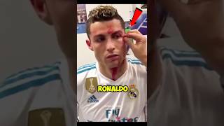 Ronaldo almost died because of this😱😱 [upl. by Amann853]