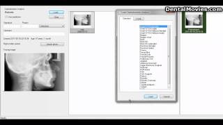 The software FACAD  Import a DICOM image file 19 [upl. by Anialem]