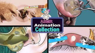 ASMR Removal of navel stones ingrown toenails ear cleaning eye stye treatment animation asmr [upl. by Josi]