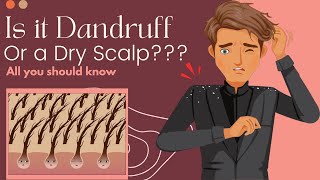 Is It Dandruff Or A Dry Scalp Heres What You Need To Know [upl. by Ikeda434]