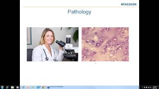 Mastering ICD10CM for Radiology Pathology and Lab Webinar [upl. by Ruscher]