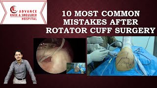 10 Most Common mistakes following Rotator cuff surgery [upl. by Anayad527]