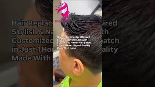 Hair Replacementget Human Hair patch in Superb Quality at Touch Dermaclinicus80778432577840050530 [upl. by Drawoh483]