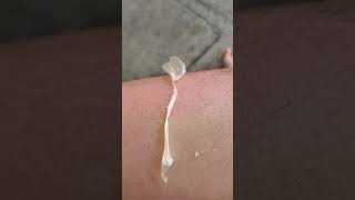 Peeling off large patch of sunburn skin 1080p [upl. by Lap78]