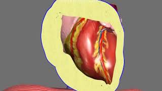 Pericardiocentesis in Pericardial Effusion and Cardiac Tamponade Animation by Cal Shipley MD [upl. by Afnin781]