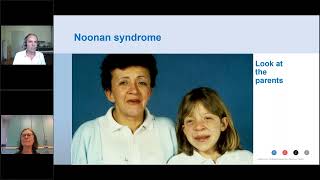 Noonan syndrome current guidelines regarding growth endocrinology and growth hormone therapy [upl. by Dario]