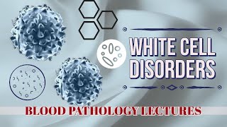 WHITE CELLS DISORDERS lecture 11 Extranodal Marginal Zone Lymphoma in easy way [upl. by Conlee367]