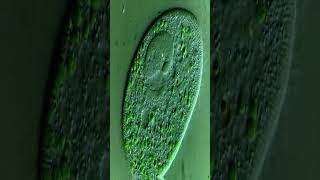 Cyanobacteria  bacterial surface  Blue green algae bloom  Chemiclean  Chemiclean cyanobacteria [upl. by Starinsky]