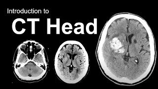 Introduction to CT Head Approach and Principles [upl. by Yk657]