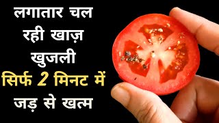 दाद खाजखुजली को जड़ से खत्म करने का 100 घरेलू उपाय  Natural way to get rid of itching  Khujli [upl. by Itsrejk]