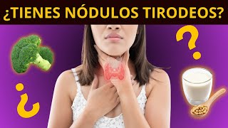 ¿TIENES NÓDULOS TIROIDEOS síntomas diagnóstico y tratamiento [upl. by Lossa]