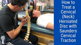 How to Treat a CervicalNeck Herniated DiscSaunders Cervical Traction [upl. by Tosch]