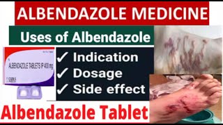 Albendazole tablets uses  ip 400mg  doses for adults and children and common side effects [upl. by Backer]