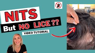 Nits But No Lice Tutorial [upl. by Annawot17]