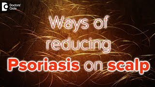 What helps psoriasis on scalp  Dr Rasya Dixit [upl. by Aneleasor]