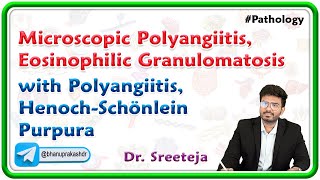 3 Microscopic Polyangiitis Eosinophilic Granulomatosis with Polyangiitis HenochSchönlein Purpura [upl. by Janean]