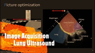 Image Acquisition Lung Ultrasound Perioperative amp Critical Care POCUS [upl. by Damita]