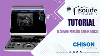 Tutorial ecógrafo Chison Ebit 30 [upl. by Llenehs]