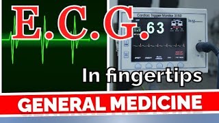 ECG in Fingertips  GENERAL MEDICINE DRAKD [upl. by Jordison261]