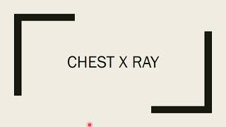 AP and PA view chest xray  How to differentiate [upl. by Estell]