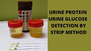 URINE ALBUMIN AND URINE GLUCOSE TEST PROCEDURE BI PARAMETER STRIP METHOD MLTPRACTICAL [upl. by Latsyrcal]