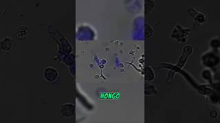 Así se SACRIFIC un Neutrófilo VS Hongo bajo microscopio curiosidades ciencia microscopia [upl. by Ggerc]