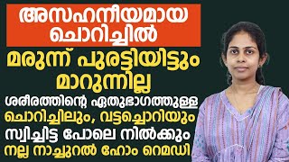 ശരീരത്തിന്റെ ഏതുഭാഗത്തുള്ള ചൊറിച്ചിലും വട്ടച്ചൊറിയും മാറാൻ നല്ല നാച്ചുറൽ ഹോം റെമഡിvattachori maran [upl. by Gifferd]