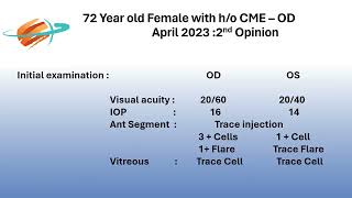 Alendronate induced Cystoid Macular Edema mistakenly treated with multiple intravitreal stero [upl. by Flin]