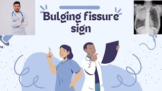 Bulging fissure sign [upl. by Cichocki]