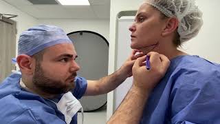 Submental Liposuction Double Chin Liposuction Journey with Centre for Surgery [upl. by Erleena]