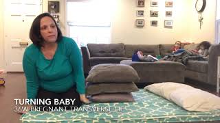 Transverse Lie  turning baby at 36weeks pregnant [upl. by Duarte]