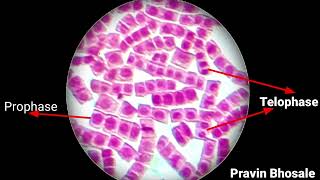 How to identify mitosis stages under microscope  Mitosis Slide  Prophase  Metaphase  Anaphase [upl. by Enillebyam]