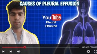 Causes of Pleural Effusion  Medical Surgical Nursing [upl. by Asirehc548]