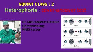 COVER uncover TEST  heterophoria  SQUINT CLASS  ophthalmology classes  strabismus [upl. by Idyak]