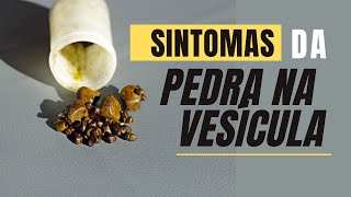 Sintomas de PEDRA NA VESÍCULA Quando a dor não é da pedra na vesícula [upl. by Lecia]