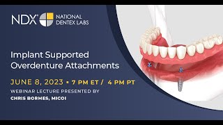 Implant Supported Overdenture Attachments [upl. by Ansaev]