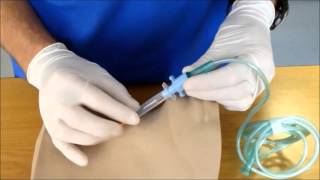 Needle Cricothyroidotomy [upl. by Atinrehs473]