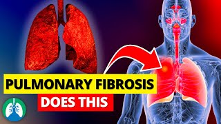 Pulmonary Fibrosis Does THIS to Your Lungs [upl. by Nahtan708]