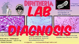 Lab diagnosis of Cdiphtheriae [upl. by Aholla]