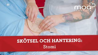 Skötsel och hantering  Stomi [upl. by Eeb]