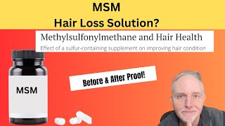 MSM for Fuller Healthier Hair Growth Latest Research [upl. by Cristabel]