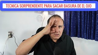 TECNICA SORPRENDENTE PARA SACAR BASURA DE EL OJO NUEVO METODO Y ANTERIOR [upl. by Rand]